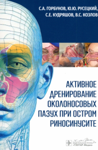  - Активное дренирование околоносовых пазух при остром риносинусите