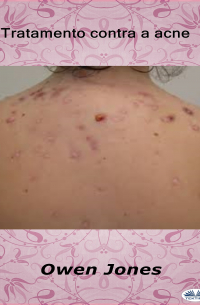 Owen Jones - Tratamento Contra A Acne