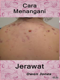 Owen Jones - Cara Menangani Jerawat